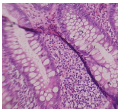 Digital Microscope